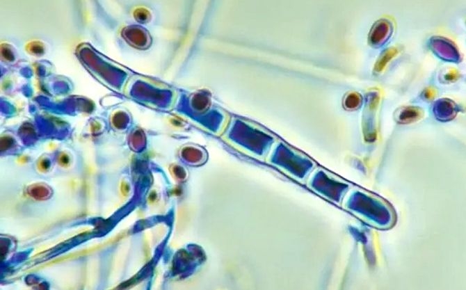 Laboratorio de Micología