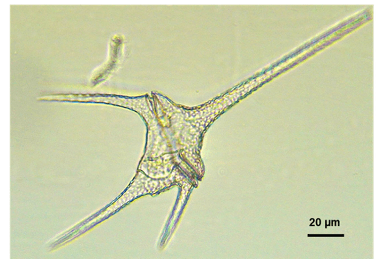 Artículo científico | A Comparison of eDNA Metabarcoding and Microscopy Techniques to Analyze Algal Diversity in Lake Titicaca, Peru