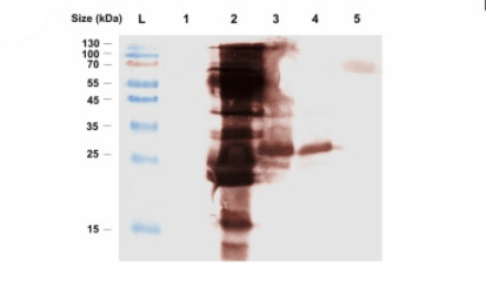 Artículo científico | Beyond the full-length toxin: The metalloprotease domain of Pictolysin-III retains key functional properties and cellular activity